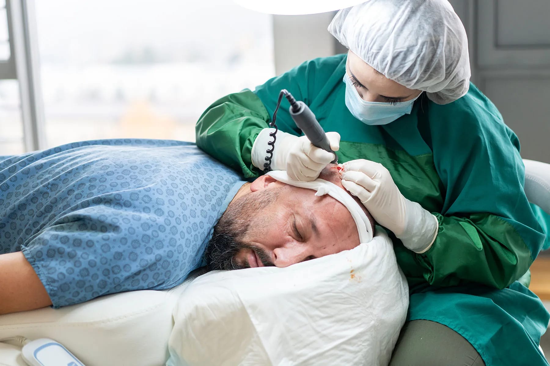 Hair Transplant – How It Works and What to Expect