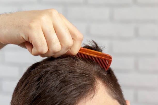 Hair Transplant Turkey Cost: Affordable Packages Explained